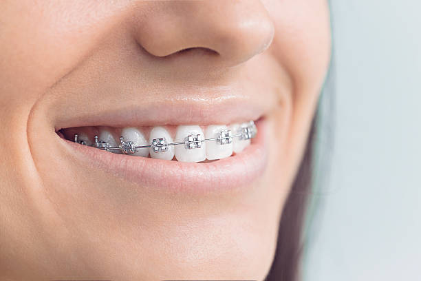 Professional  Holistic Dental Services in Peabody, MA